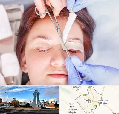 جراحی پلک افتاده در تایباد