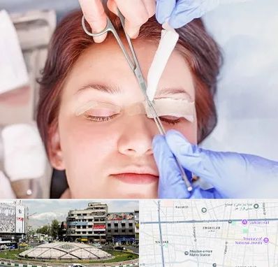 جراحی پلک افتاده در مرکز تهران