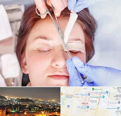 جراحی پلک افتاده در مارلیک کرج