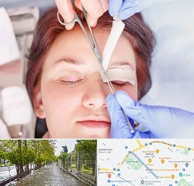 جراحی پلک افتاده در خیابان ارم شیراز