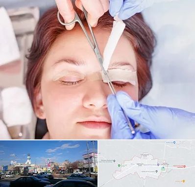 جراحی پلک افتاده در ماهدشت کرج