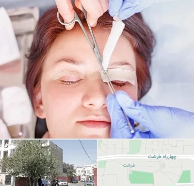 جراحی پلک افتاده در طرشت