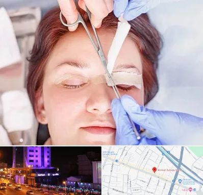 جراحی پلک افتاده در آبرسان تبریز