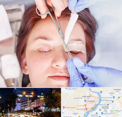 جراحی پلک افتاده در کیانپارس اهواز