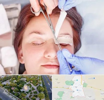 جراحی پلک افتاده در کاشمر