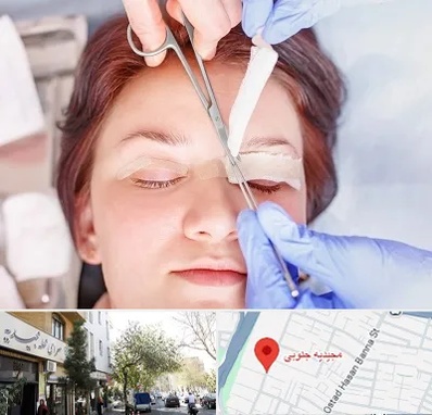 جراحی پلک افتاده در مجیدیه جنوبی
