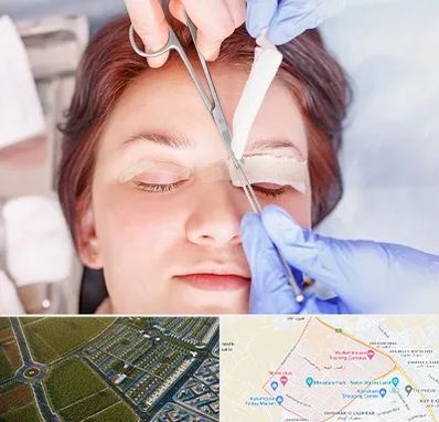 جراحی پلک افتاده در الهیه مشهد