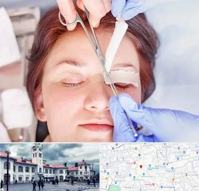 جراحی پلک افتاده در میدان شهرداری رشت