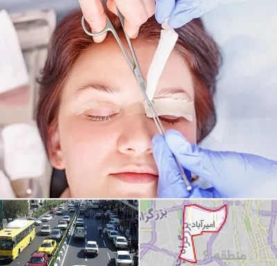 جراحی پلک افتاده در امیرآباد