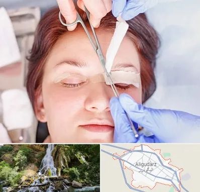 جراحی پلک افتاده در الیگودرز