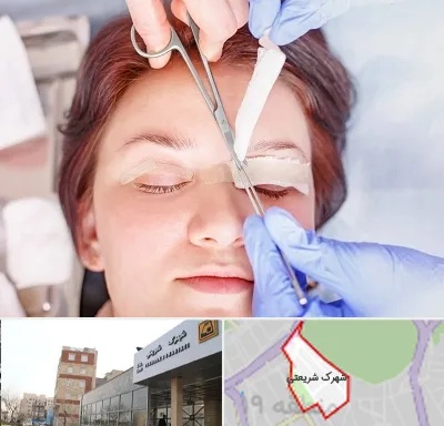 جراحی پلک افتاده در شهرک شریعتی
