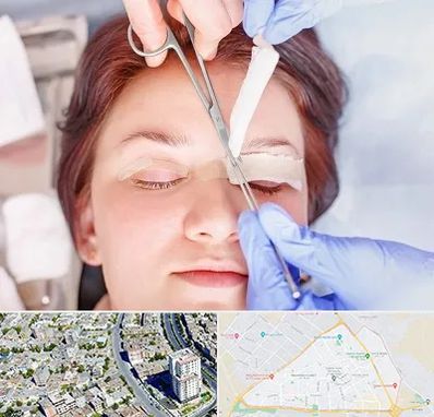 جراحی پلک افتاده در قاسم آباد مشهد