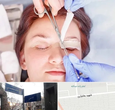 جراحی پلک افتاده در سی متری جی