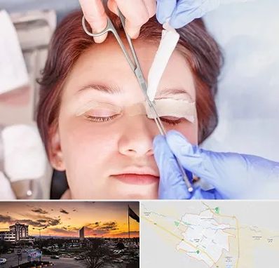 جراحی پلک افتاده در قوچان