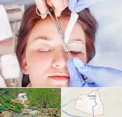 جراحی پلک افتاده در کردان