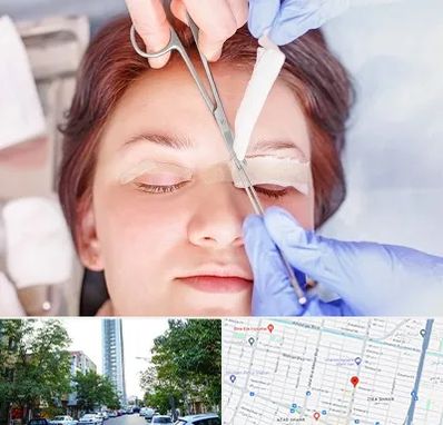 جراحی پلک افتاده در امامت مشهد