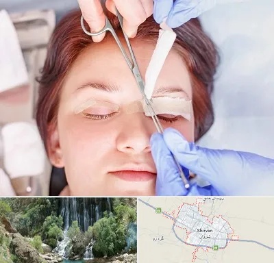 جراحی پلک افتاده در شیروان