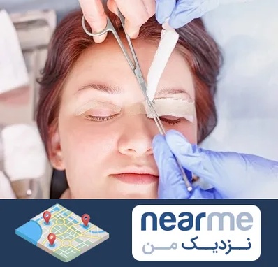 جراحی پلک افتاده در نزدیک من