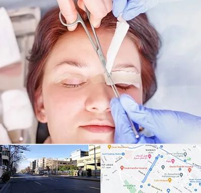 جراحی پلک افتاده در خیابان ملاصدرا شیراز