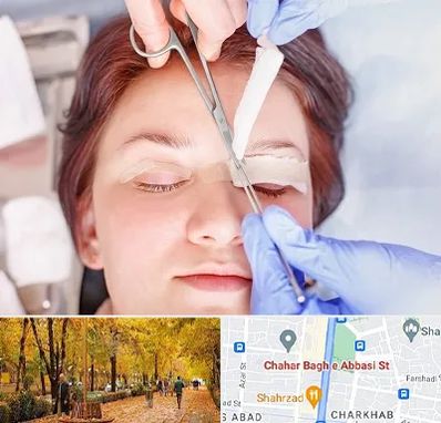جراحی پلک افتاده در چهارباغ اصفهان