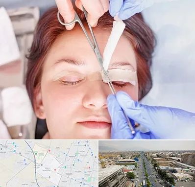 جراحی پلک افتاده در حصارک کرج