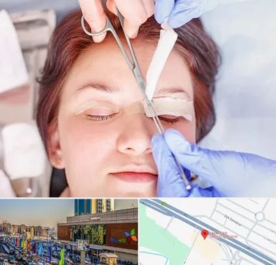 جراحی پلک افتاده در لاله پارک تبریز