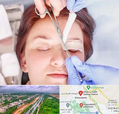 جراحی پلک افتاده در قصرالدشت شیراز