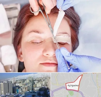جراحی پلک افتاده در محمودیه