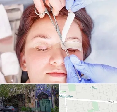 جراحی پلک افتاده در بریانک
