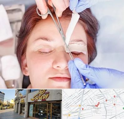 جراحی پلک افتاده در عطاران قم