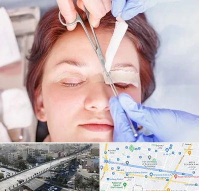 جراحی پلک افتاده در فرجام