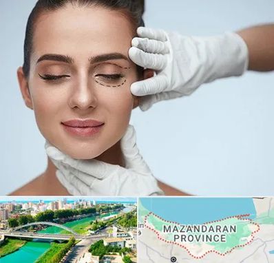 عمل پف چشم در مازندران
