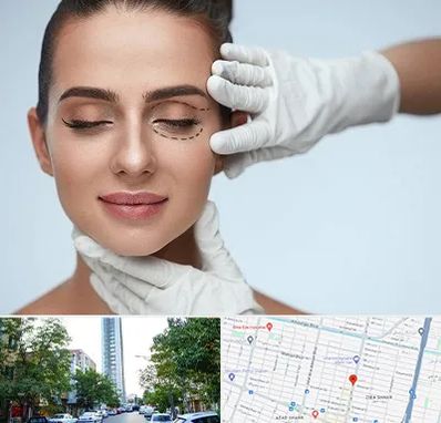 عمل پف چشم در امامت مشهد