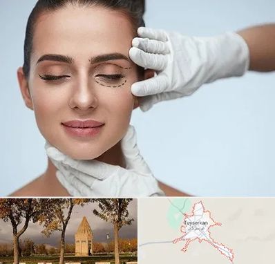 عمل پف چشم در تویسرکان