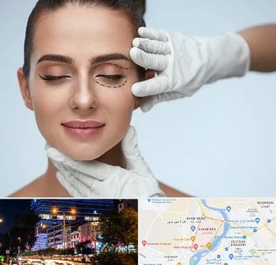 عمل پف چشم در کیانپارس اهواز