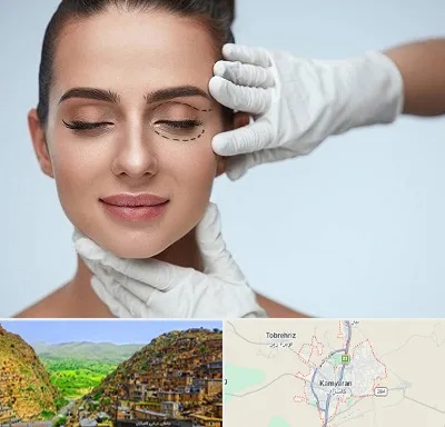 عمل پف چشم در کامیاران