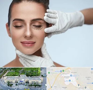 عمل پف چشم در نسیم شهر