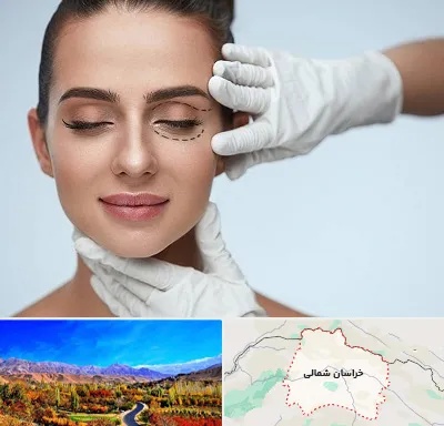 عمل پف چشم در خراسان شمالی