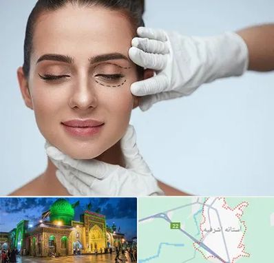 عمل پف چشم در آستانه اشرفیه