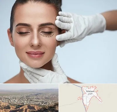 عمل پف چشم در اسفراین