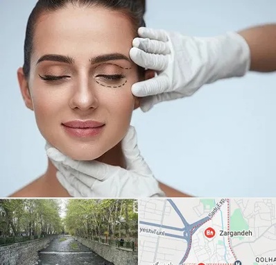 عمل پف چشم در زرگنده