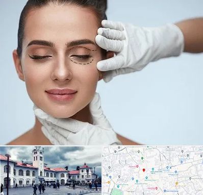 عمل پف چشم در میدان شهرداری رشت