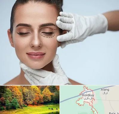 عمل پف چشم در کردکوی