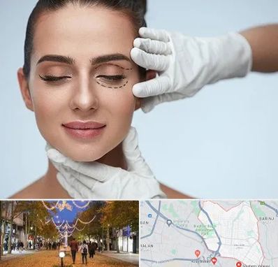 عمل پف چشم در ولیعصر ارومیه