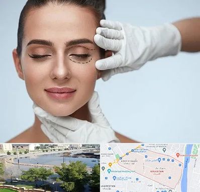 عمل پف چشم در گلستان اهواز