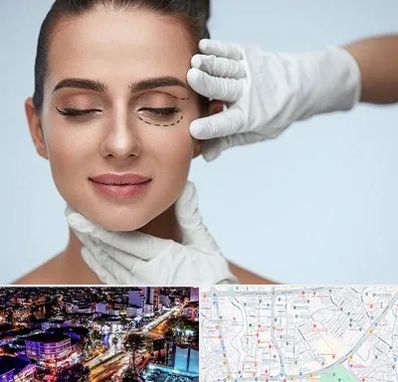 عمل پف چشم در منظریه رشت