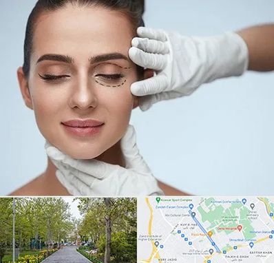 عمل پف چشم در قدوسی غربی شیراز