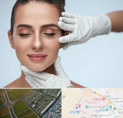 عمل پف چشم در الهیه مشهد