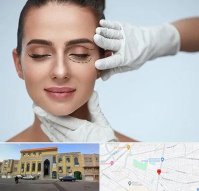 عمل پف چشم در زنبیل آباد قم