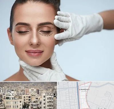 عمل پف چشم در اسکندری